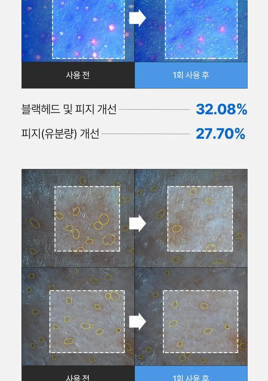[피지연화코팩] 메디필 엑스트라 슈퍼 9 플러스 블랙헤드 아웃 코팩 5매 상세페이지 19